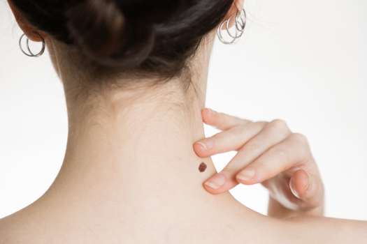 Giving GPs cameras to photograph skin complaints could help slash wait times for hospital appointments.  Credit: Getty Images /  Idar Abulkhanov