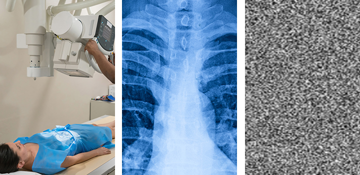 How chaos theory could turn every NHS scan into its own fortress