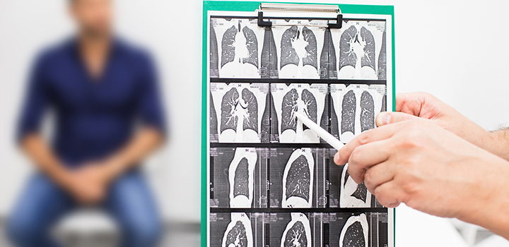 A doctor inspects a scan of a pair of lungs.