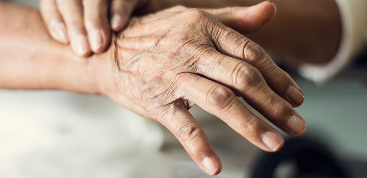 Boost for UEA research on skin microbiome and healthy aging