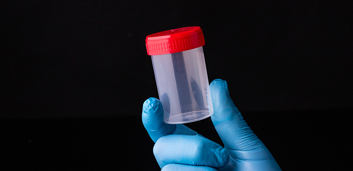 Five types of bacteria linked to aggressive prostate cancer