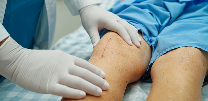 Older knee replacements as good as newer models study shows