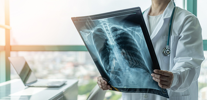 A doctor examining an x-ray.