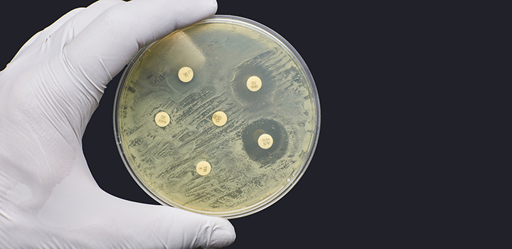Tracking the global spread of antimicrobial resistance